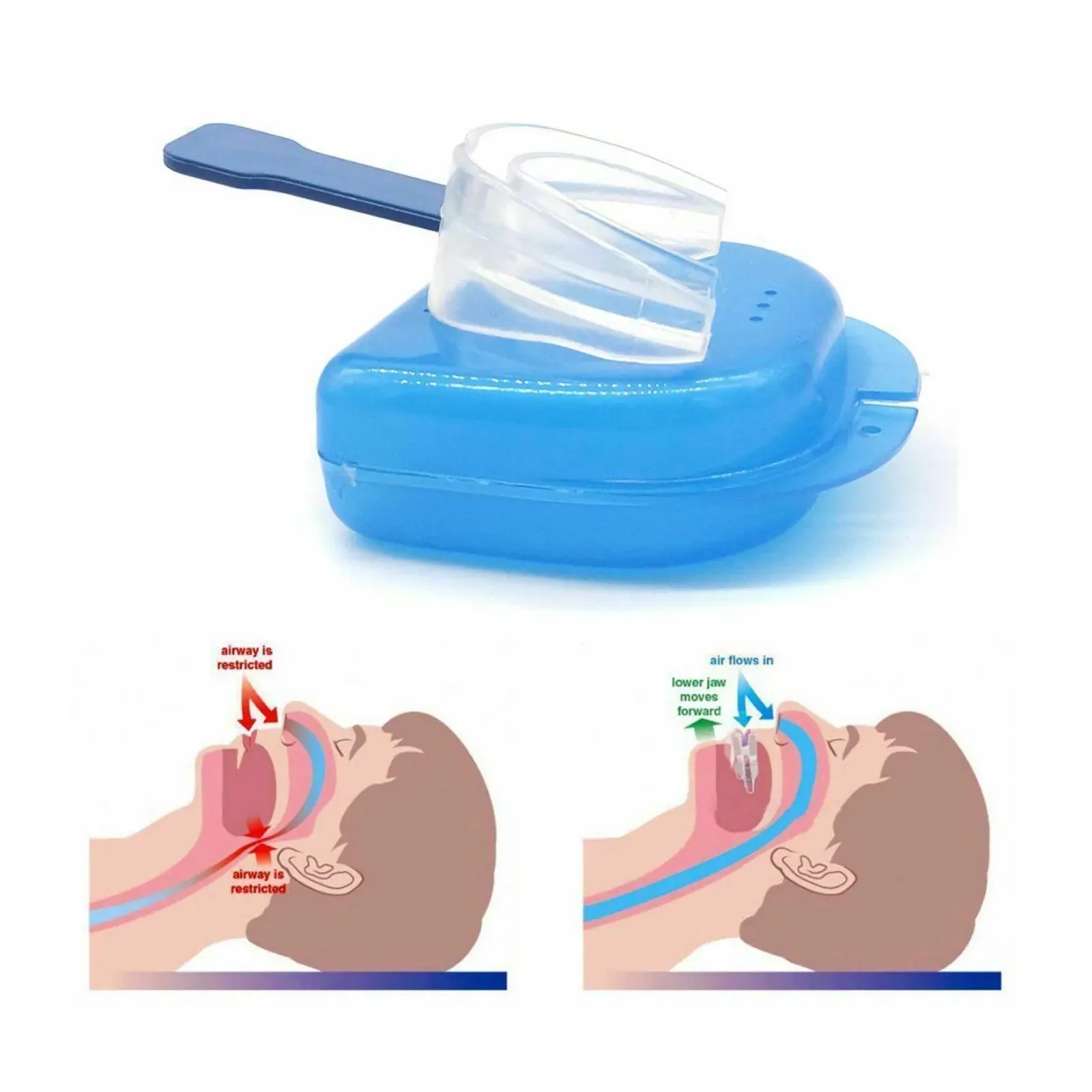 Anti Snoring Aid Mouth Guard - Adjustable Sleeping and Breathing Mouthguard Price