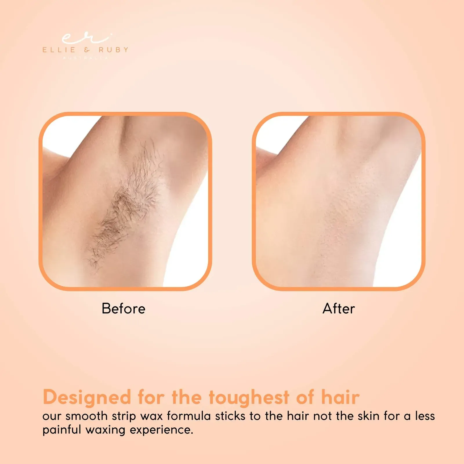 400g Soft Wax Hair Removal - Aloe Vera Depilatory For Salon Pot Warmer Price